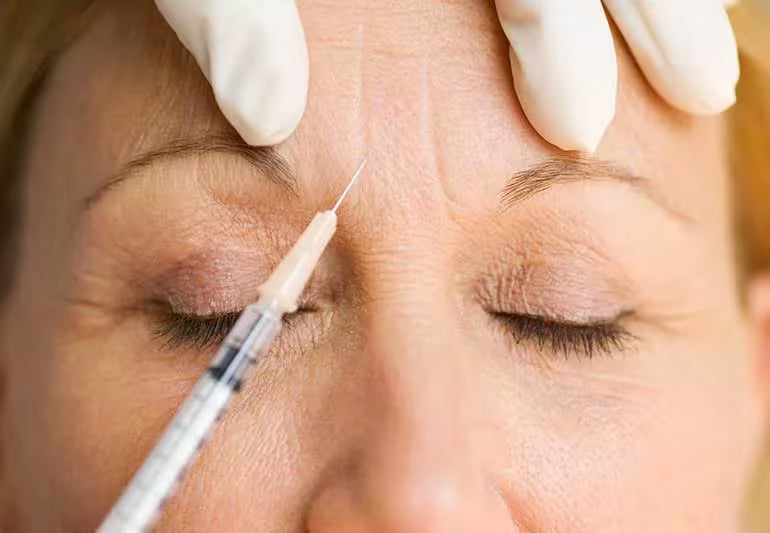 Botulinum Toxin
